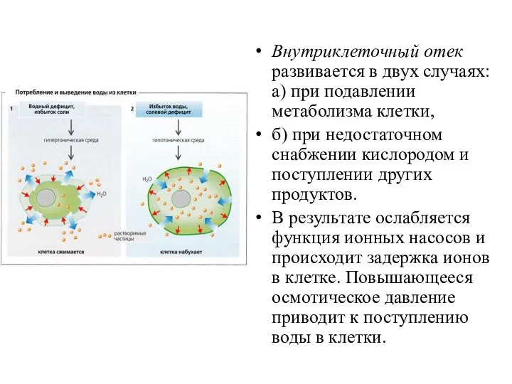 Внутриклеточный отек развивается в двух случаях: а) при подавлении метаболизма клетки, б)