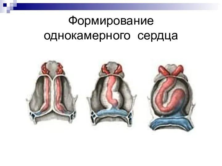 Формирование однокамерного сердца