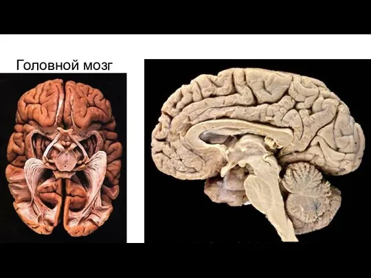 Головной мозг