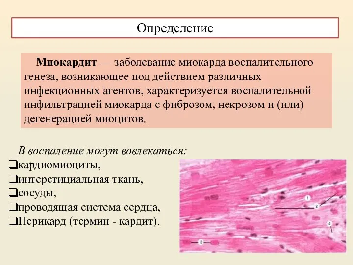 Миокардит — заболевание миокарда воспалительного генеза, возникающее под действием различных инфекционных агентов,