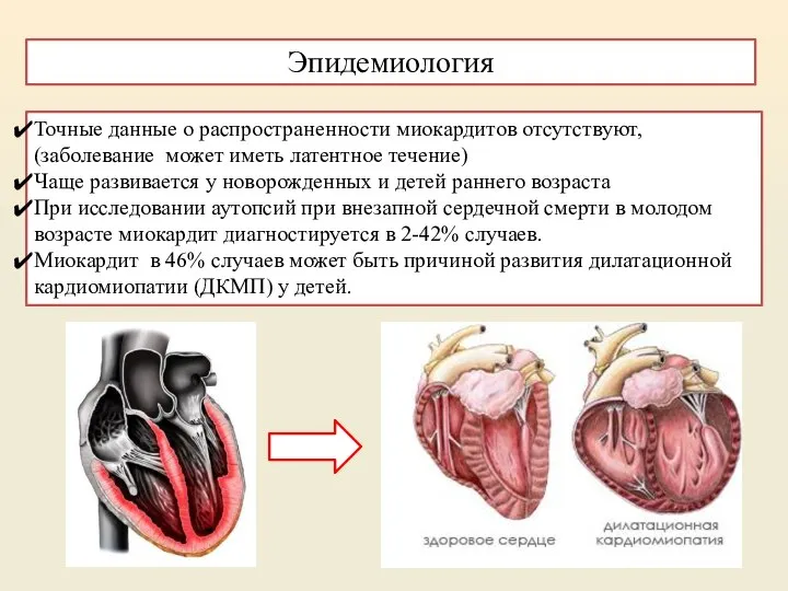 Точные данные о распространенности миокардитов отсутствуют, (заболевание может иметь латентное течение) Чаще