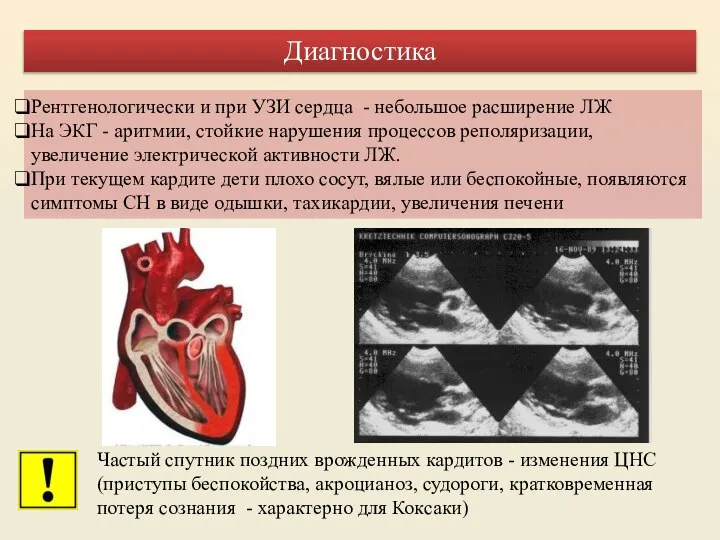 Рентгенологически и при УЗИ сердца - небольшое расширение ЛЖ На ЭКГ -
