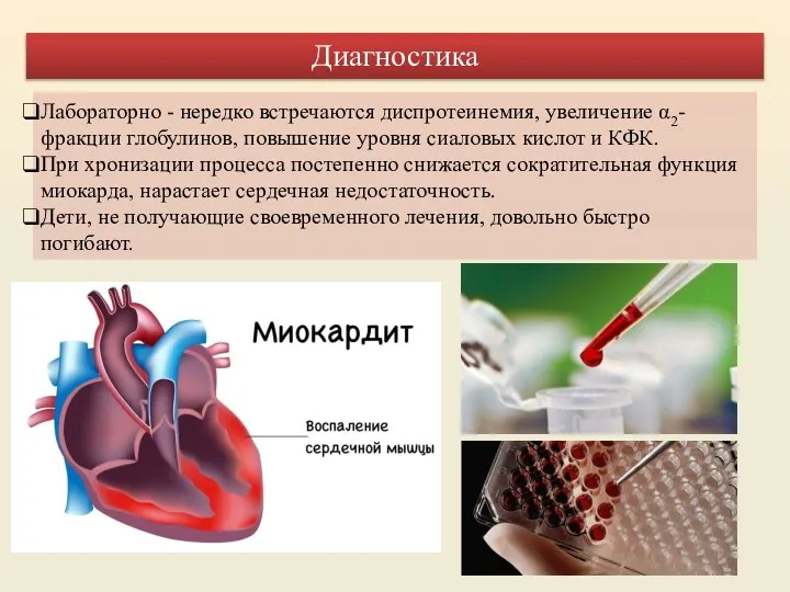 Лабораторно - нередко встречаются диспротеинемия, увеличение α2-фракции глобулинов, повышение уровня сиаловых кислот