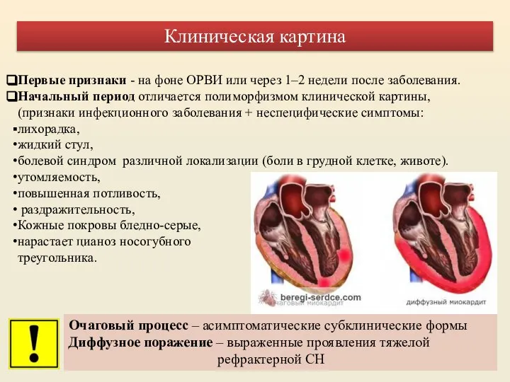 Первые признаки - на фоне ОРВИ или через 1–2 недели после заболевания.