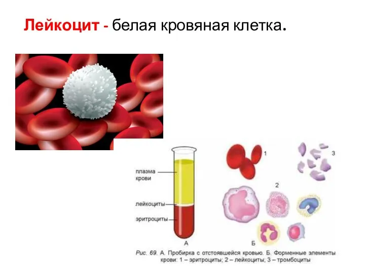 Лейкоцит - белая кровяная клетка.