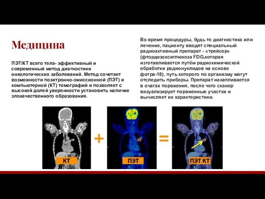 Медицина ПЭТ/КТ всего тела- эффективный и современный метод диагностики онкологических заболеваний. Метод