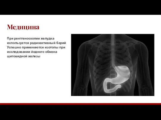 Медицина При рентгеноскопии желудка используется радиоактивный барий Успешно применяются изотопы при исследовании йодного обмена щитовидной железы