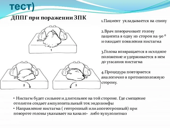 Проба Pagnini-McClure (roll-тест) 1.Пациент укладывается на спину 2.Врач поворачивает голову пациента в