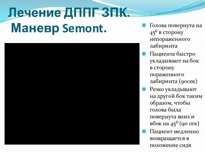 Лечение ДППГ ЗПК. Маневр Semont. Голова повернута на 45⁰ в сторону непораженного