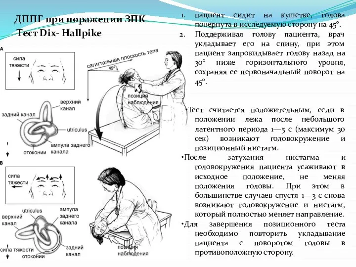 Тест Dix- Hallpike пациент сидит на кушетке, голова повернута в исследуемую сторону