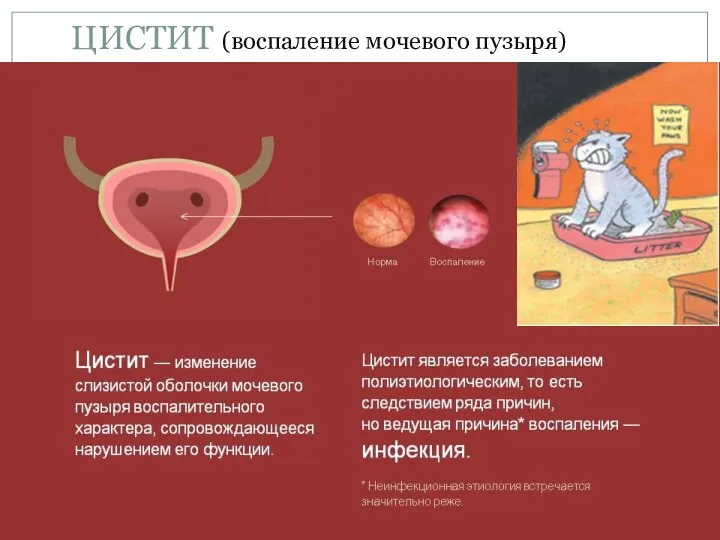 ЦИСТИТ (воспаление мочевого пузыря)