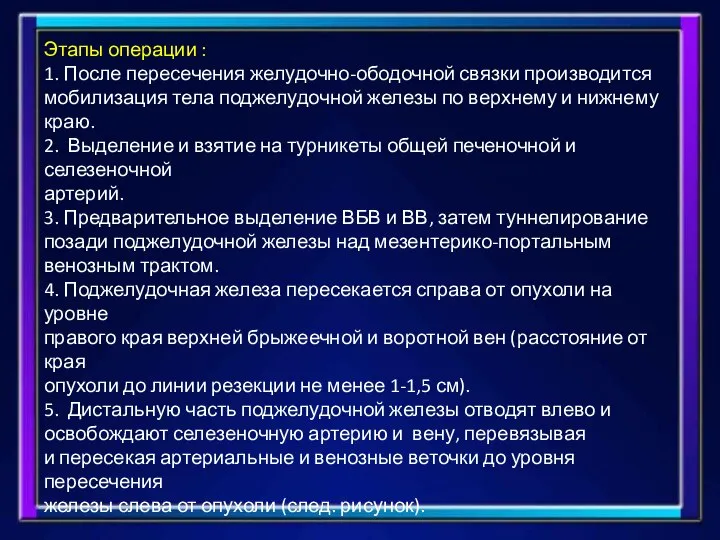 Этапы операции : 1. После пересечения желудочно-ободочной связки производится мобилизация тела поджелудочной