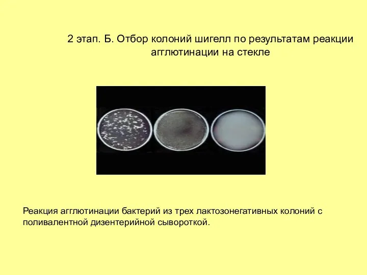 2 этап. Б. Отбор колоний шигелл по результатам реакции агглютинации на стекле