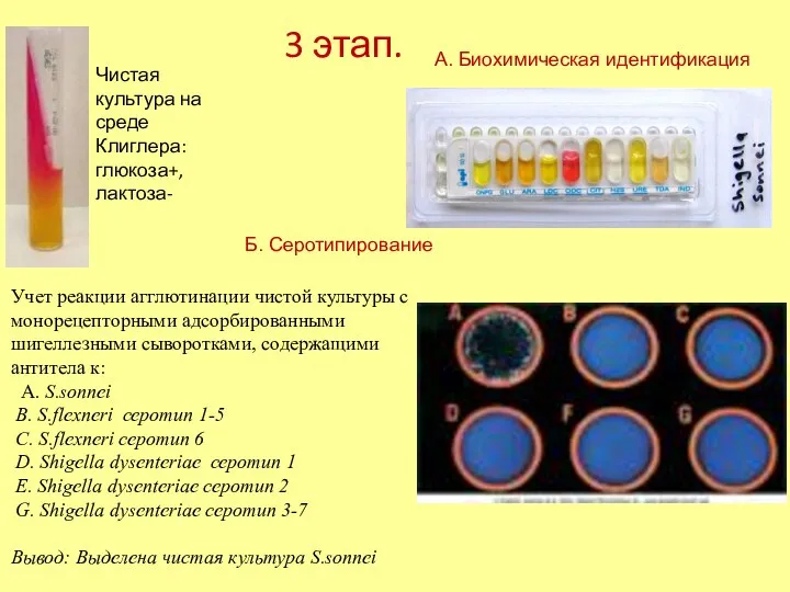 3 этап. Учет реакции агглютинации чистой культуры с монорецепторными адсорбированными шигеллезными сыворотками,