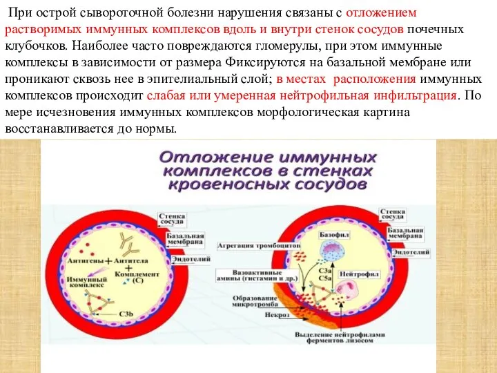 При острой сывороточной болезни нарушения связаны с отложением растворимых иммунных комплексов вдоль