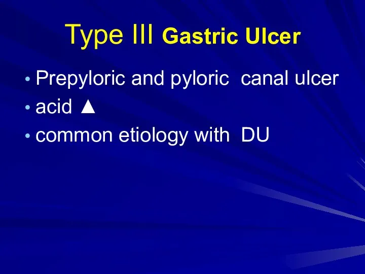 Type III Gastric Ulcer Prepyloric and pyloric canal ulcer acid ▲ common etiology with DU
