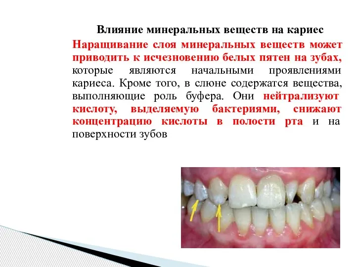 Влияние минеральных веществ на кариес Наращивание слоя минеральных веществ может приводить к