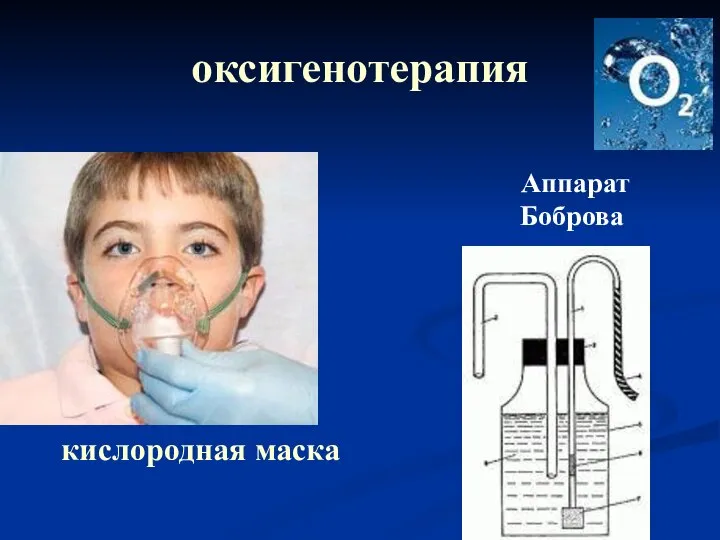 оксигенотерапия кислородная маска Аппарат Боброва