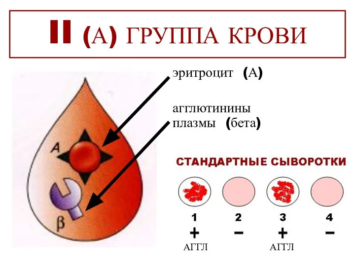 II (А) ГРУППА КРОВИ эритроцит (А) агглютинины плазмы (бета) АГГЛ АГГЛ