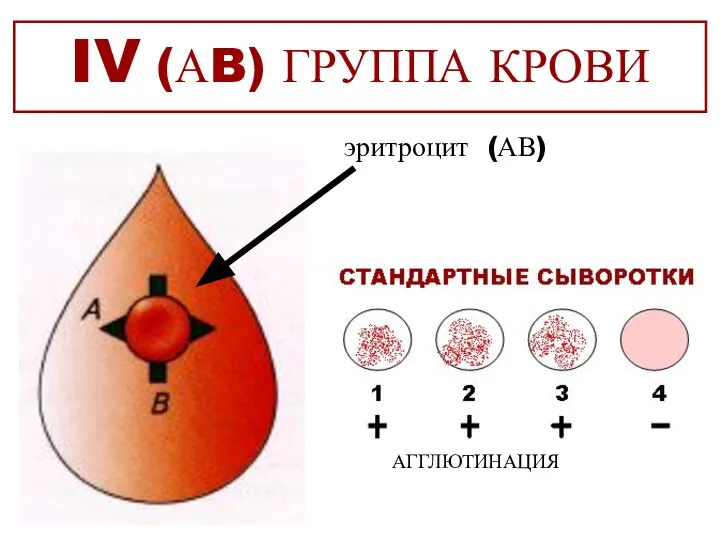 IV (АB) ГРУППА КРОВИ эритроцит (АВ) АГГЛЮТИНАЦИЯ