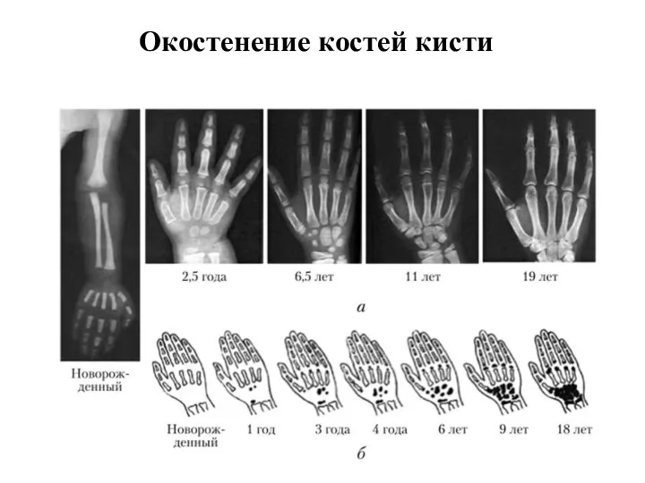 Окостенение костей кисти