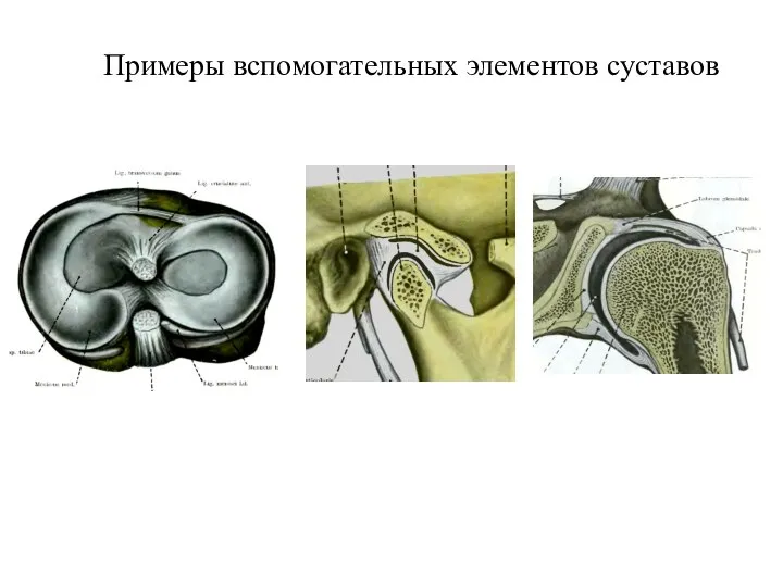 Примеры вспомогательных элементов суставов