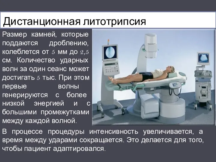 Дистанционная литотрипсия Размер камней, которые поддаются дроблению, колеблется от 5 мм до