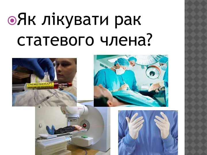 Як лікувати рак статевого члена?