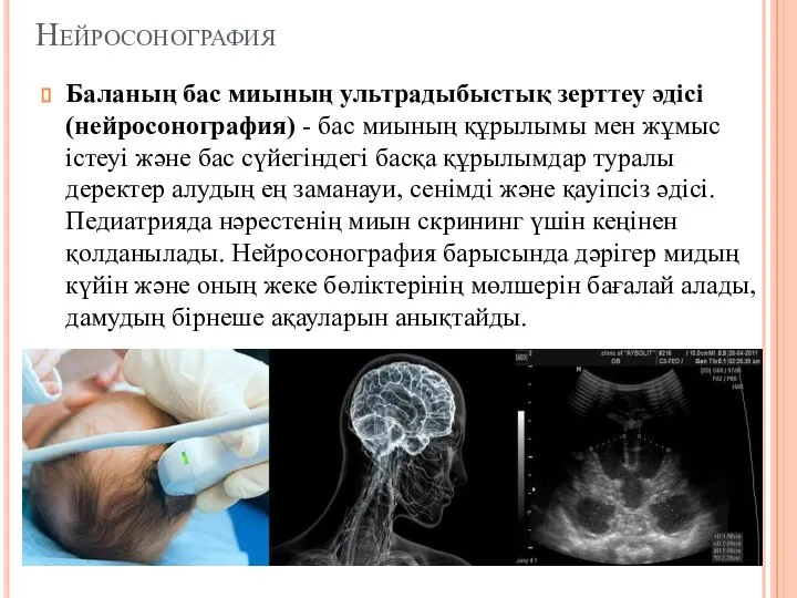 Нейросонография Баланың бас миының ультрадыбыстық зерттеу әдісі (нейросонография) - бас миының құрылымы