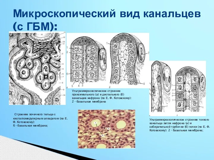 Микроскопический вид канальцев (с ГБМ): Строение почечного тельца с юкстагломерулярным аппаратом (по