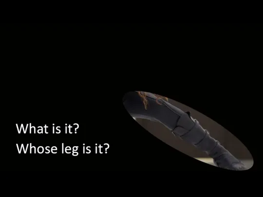 What is it? Whose leg is it?