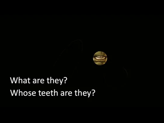 What are they? Whose teeth are they?
