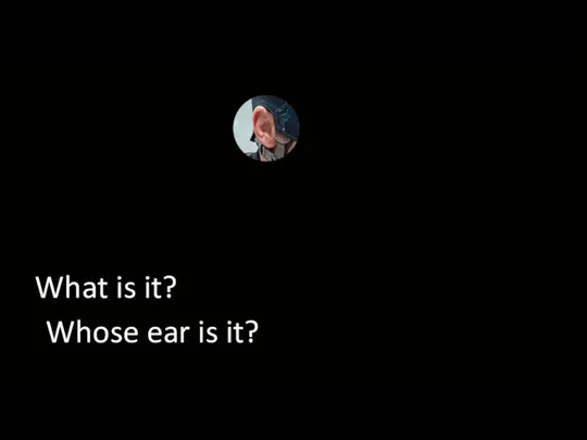 What is it? Whose ear is it?