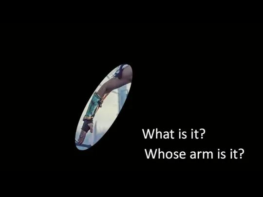 What is it? Whose arm is it?