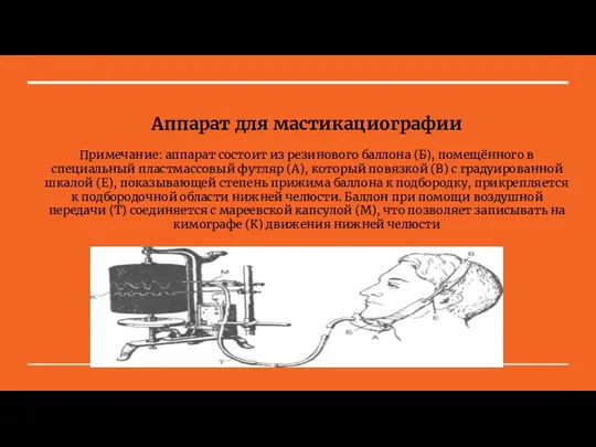 Аппарат для мастикациографии Примечание: аппарат состоит из резинового баллона (Б), помещённого в