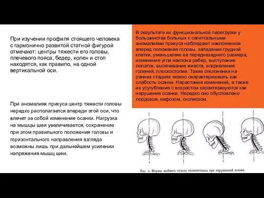 При изучении профиля стоящего человека с гармонично разви­той статной фигурой отмечают: центры