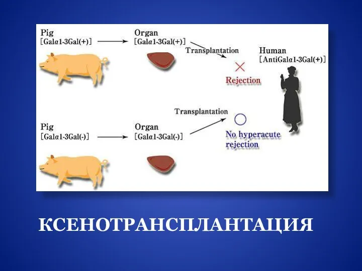 КСЕНОТРАНСПЛАНТАЦИЯ