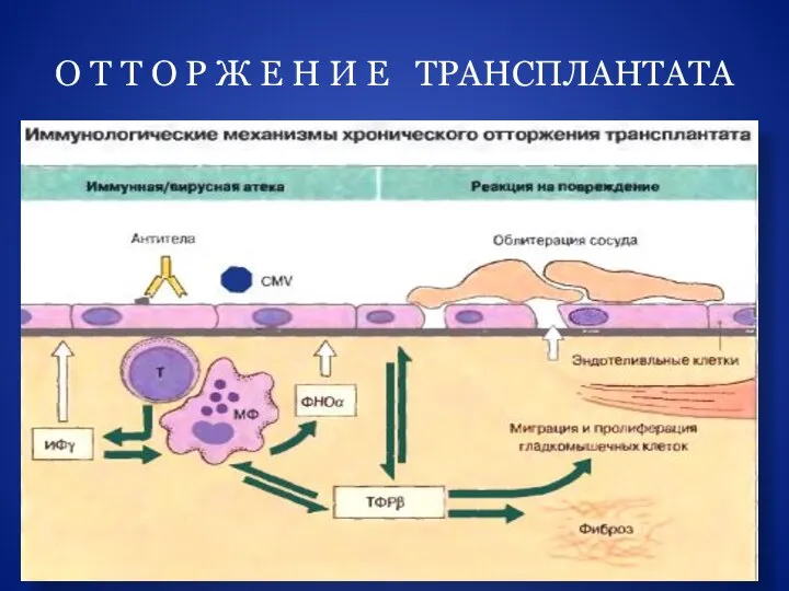 О Т Т О Р Ж Е Н И Е ТРАНСПЛАНТАТА