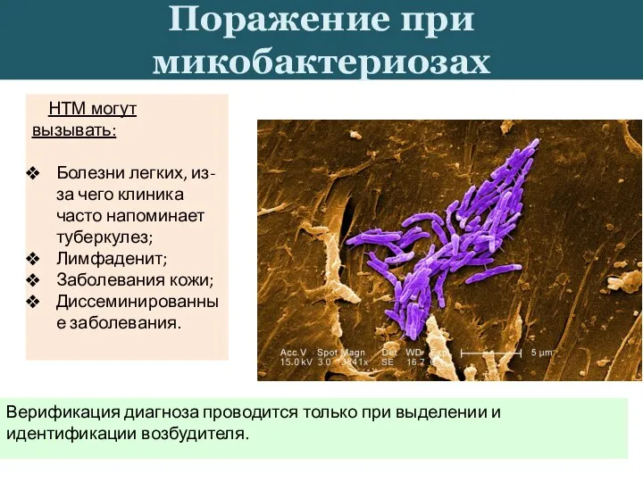 Верификация диагноза проводится только при выделении и идентификации возбудителя. Поражение при микобактериозах