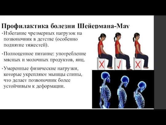 Профилактика болезни Шейермана-Мау Избегание чрезмерных нагрузок на позвоночник в детстве (особенно поднятие