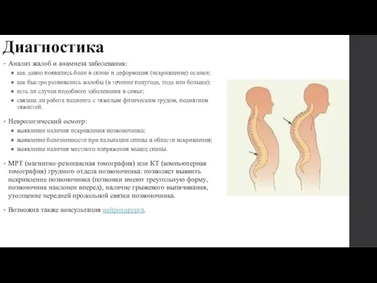 Диагностика Анализ жалоб и анамнеза заболевания: как давно появились боли в спине