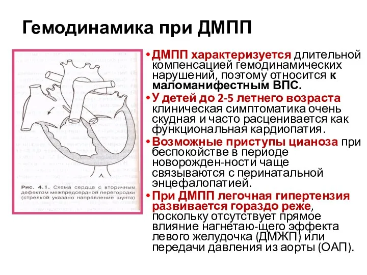 Гемодинамика при ДМПП ДМПП характеризуется длительной компенсацией гемодинамических нарушений, поэтому относится к