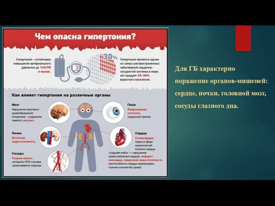 Для ГБ характерно поражение органов-мишеней: сердце, почки, головной мозг, сосуды глазного дна.