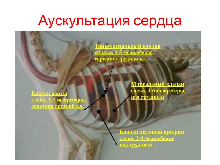 Аускультация сердца Клапан легочной артерии слева, 2-4 межреберье над грудиной Клапан аорты