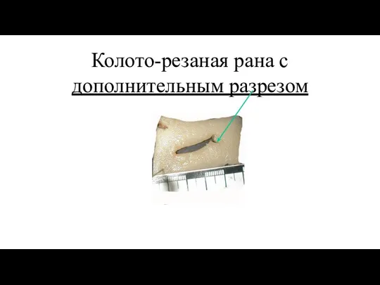 Колото-резаная рана с дополнительным разрезом