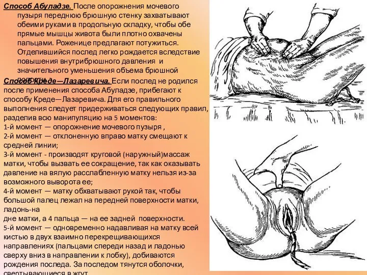 Способ Абуладзе. После опорожнения мочевого пузыря переднюю брюшную стенку захватывают обеими руками