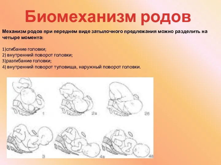 Механизм родов при переднем виде затылочного предлежания можно разделить на четыре момента: