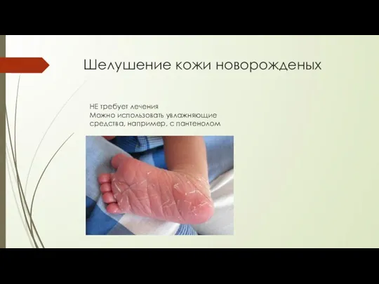 Шелушение кожи новорожденых НЕ требует лечения Можно использовать увлажняющие средства, например, с пантенолом