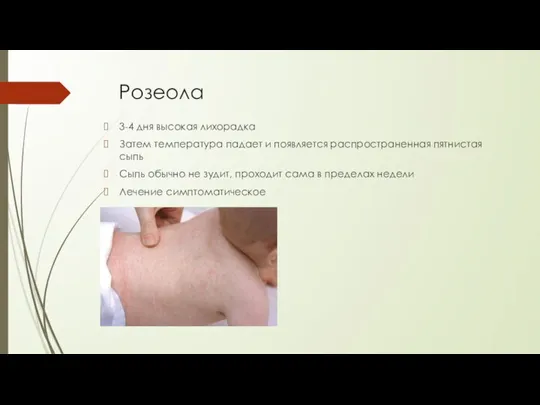 Розеола 3-4 дня высокая лихорадка Затем температура падает и появляется распространенная пятнистая