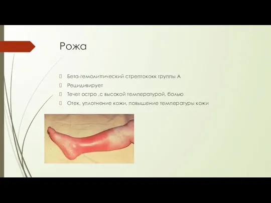 Рожа Бета-гемолиттический стрептококк группы А Рецидивирует Течет остро ,с высокой температурой, болью